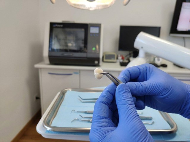 Ajuste milimétrico: coronas de cerámica Cad-Cam en Ortigueira