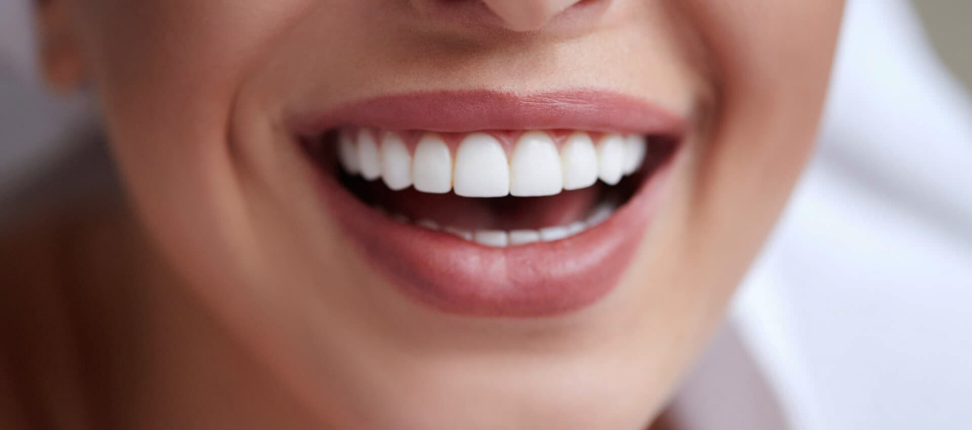 Cuide la imagen de su boca con lo último en estética dental