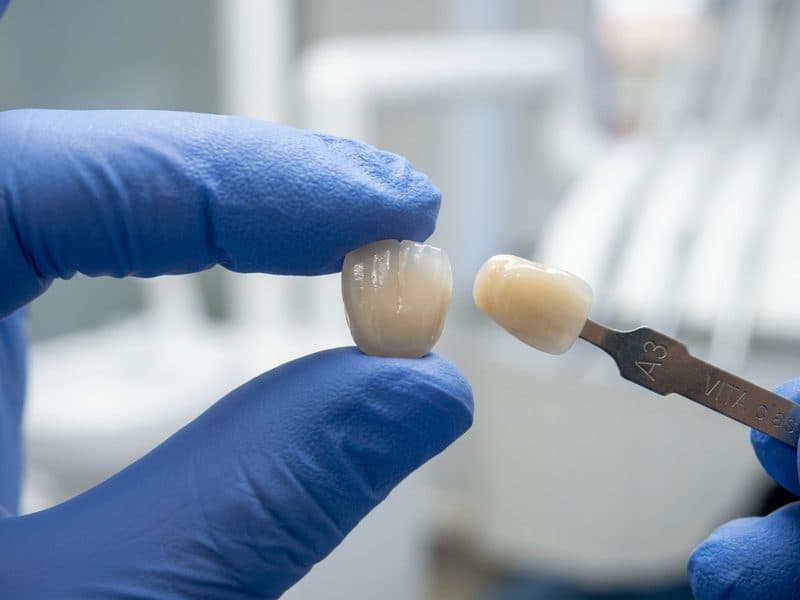 Coronas de zirconio en Ortigueira, Sigüeiro y Cariño