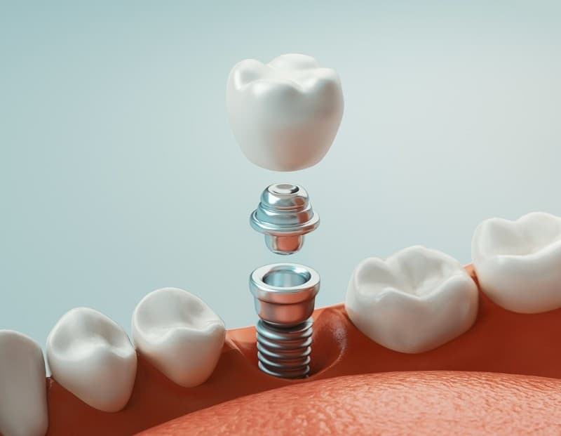 Odontología digital en Ortigueira