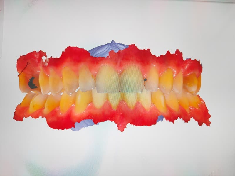 Odontología digital en Ortigueira