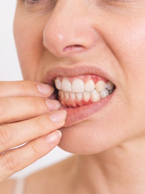 Tratamientos para la periodoncia en Ortigueira, Sigüeiro y Cariño