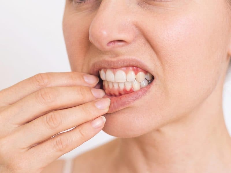 Periodoncia en Ortigueira, Sigüeiro y Cariño