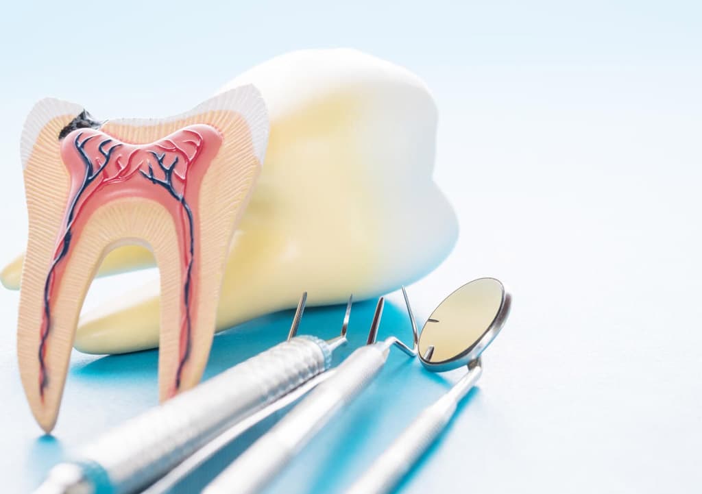 Endodoncista en Ortigueira