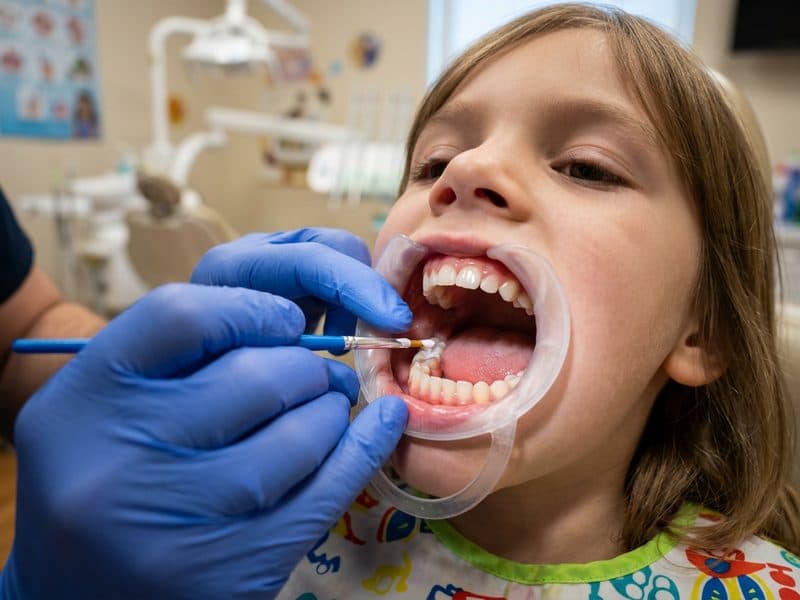 Selladores y fluorización dental infantil en Ortigueira, Sigüeiro y Cariño