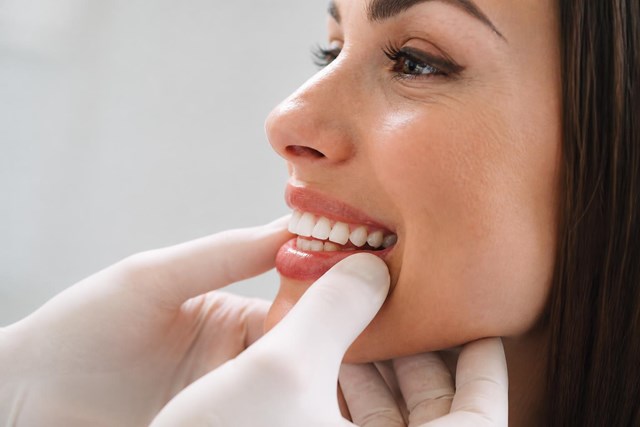 Recupere una sonrisa homogénea con carillas de cerámica en Ortigueira - Imagen 1