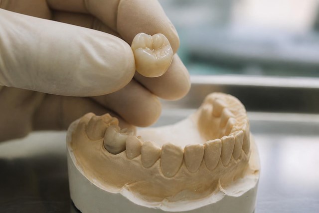 Recupere una sonrisa natural con coronas de zirconio sin metal en Cariño - Imagen 1